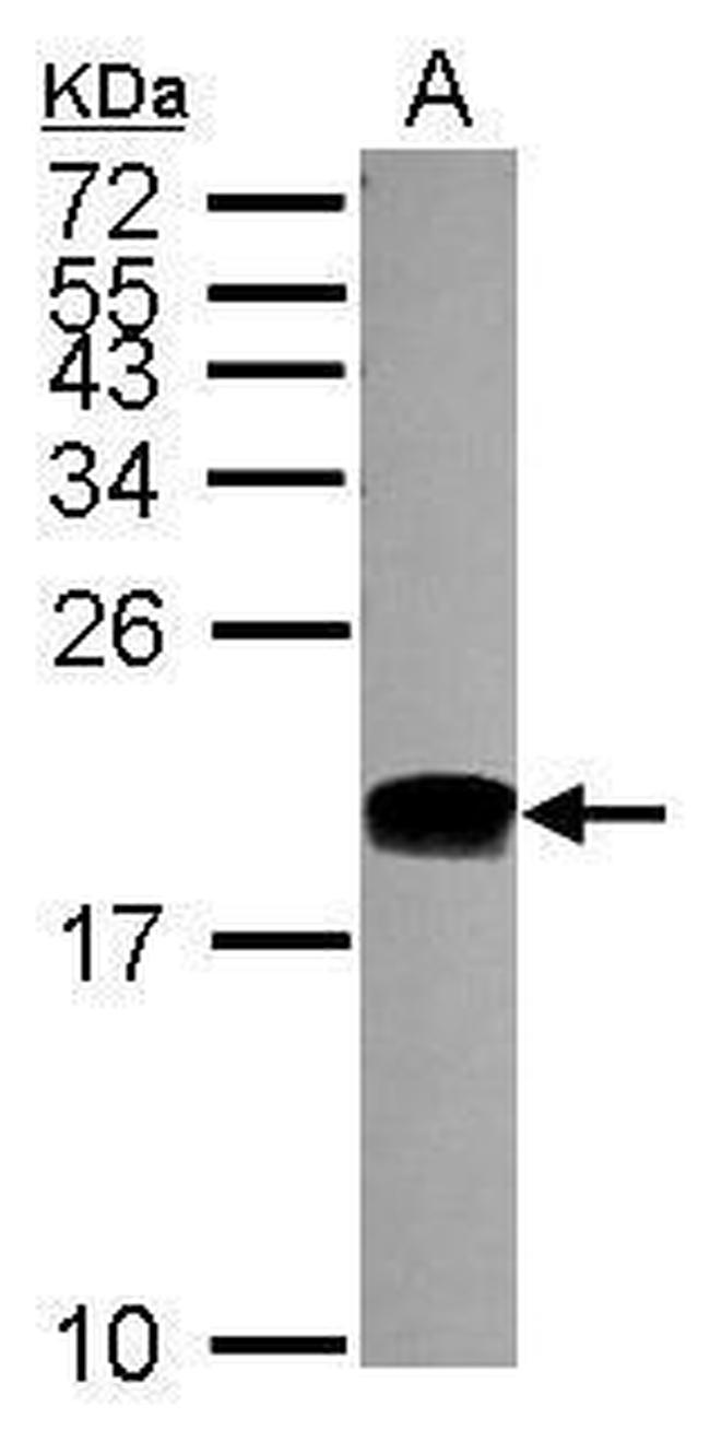 POLE3 Antibody in Western Blot (WB)