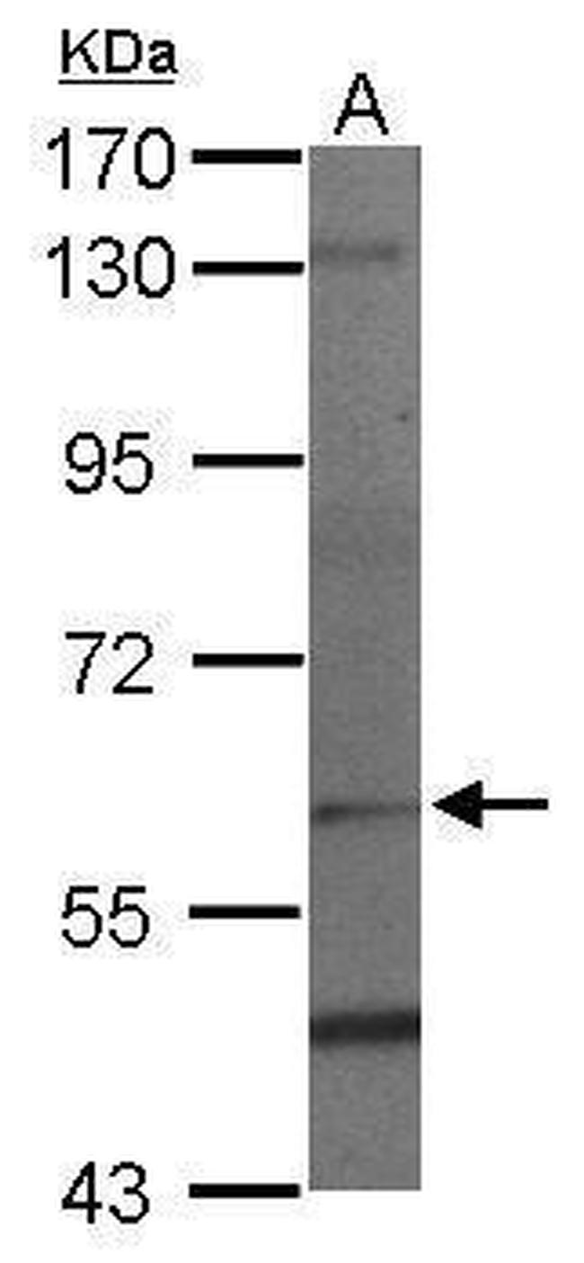 PAF1 Antibody in Western Blot (WB)