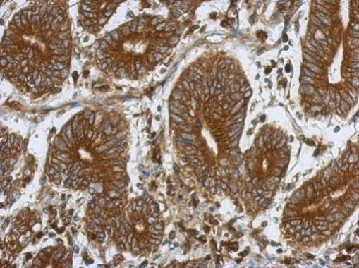 P4HTM Antibody in Immunohistochemistry (Paraffin) (IHC (P))