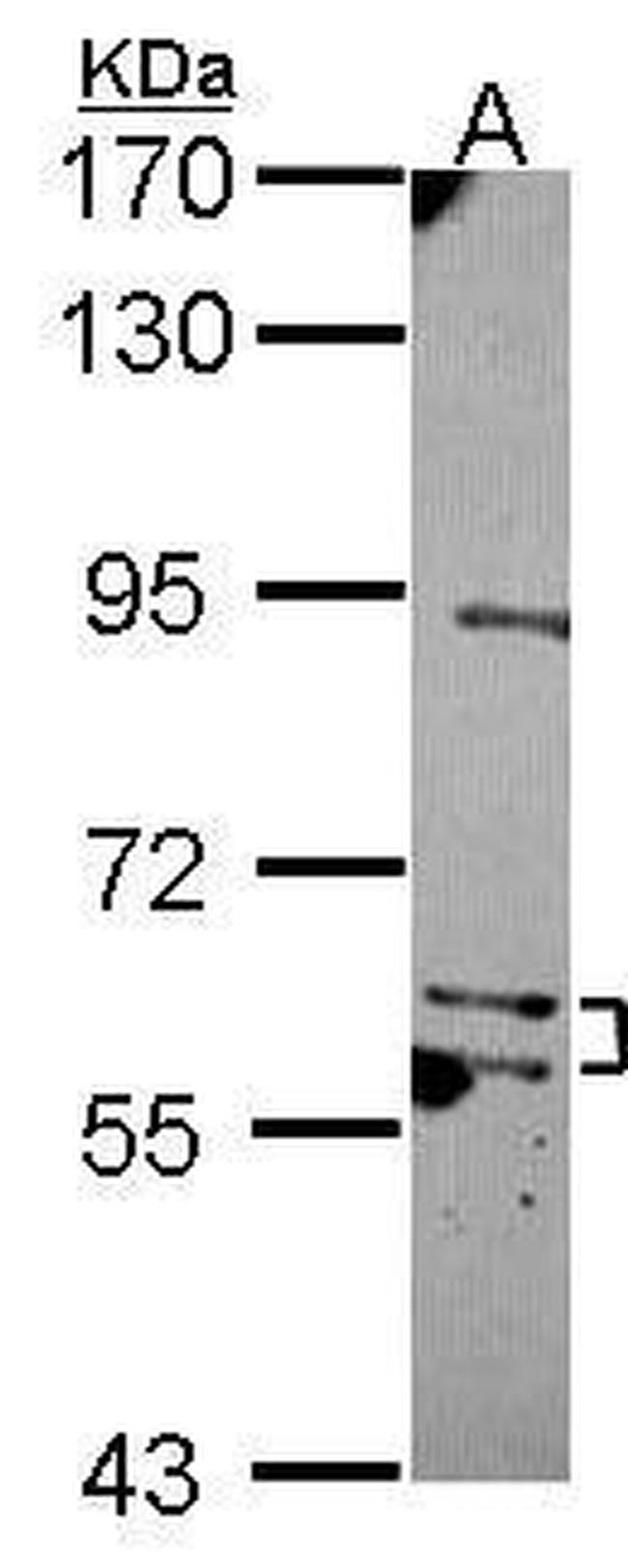 MKS1 Antibody in Western Blot (WB)