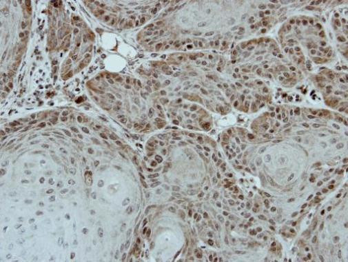 DDX28 Antibody in Immunohistochemistry (Paraffin) (IHC (P))