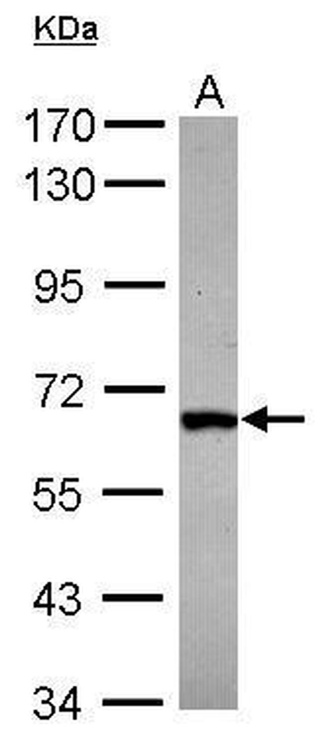 DDX28 Antibody in Western Blot (WB)