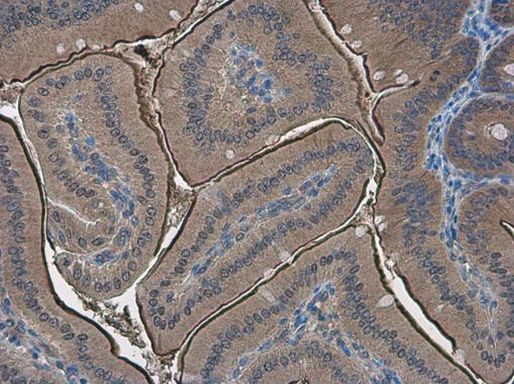 PPP2R2D Antibody in Immunohistochemistry (Paraffin) (IHC (P))