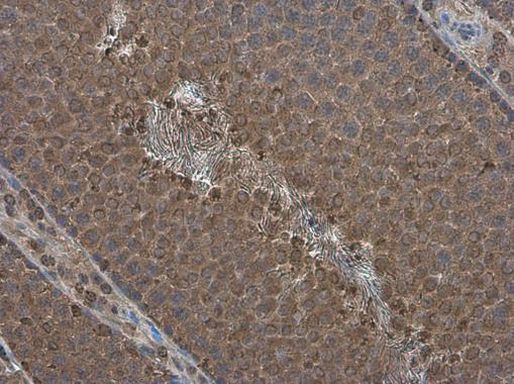 PPP2R2D Antibody in Immunohistochemistry (Paraffin) (IHC (P))