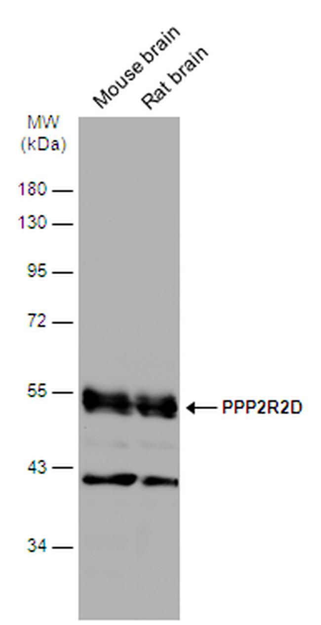 PPP2R2D Antibody in Western Blot (WB)