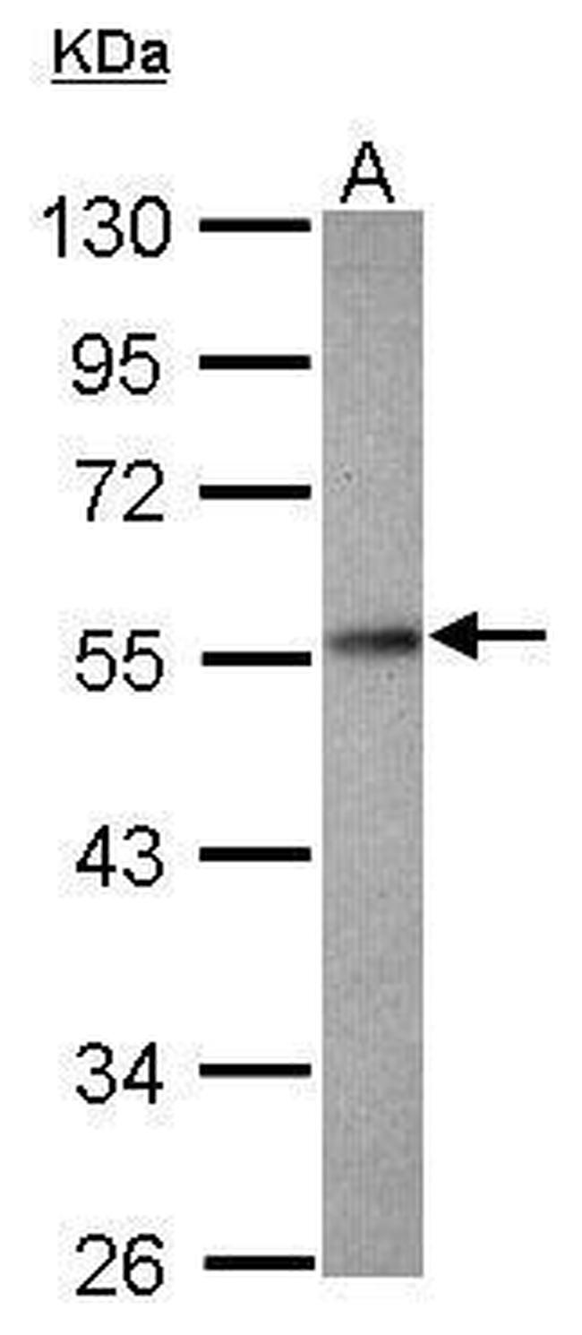 PPP2R2D Antibody in Western Blot (WB)