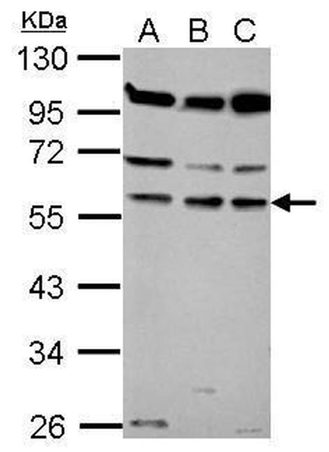 Coronin 1B Antibody in Western Blot (WB)