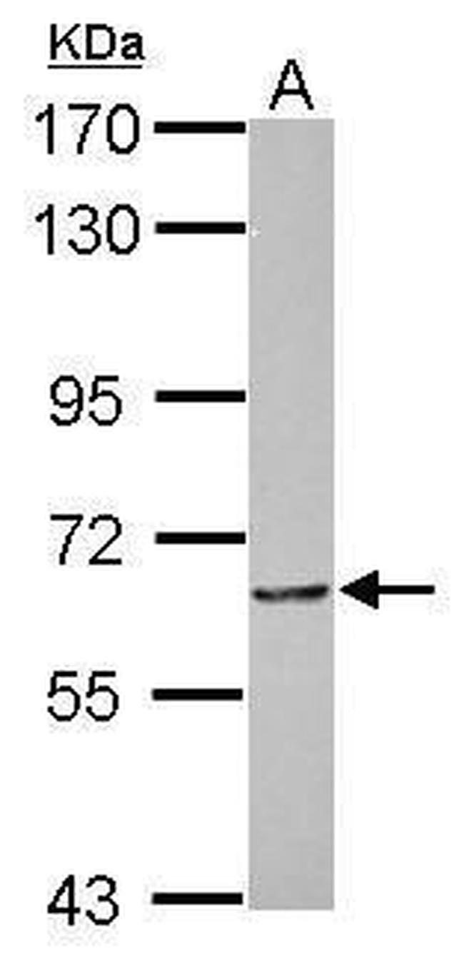 MTA3 Antibody in Western Blot (WB)