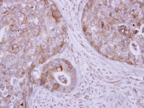 KIF17 Antibody in Immunohistochemistry (Paraffin) (IHC (P))