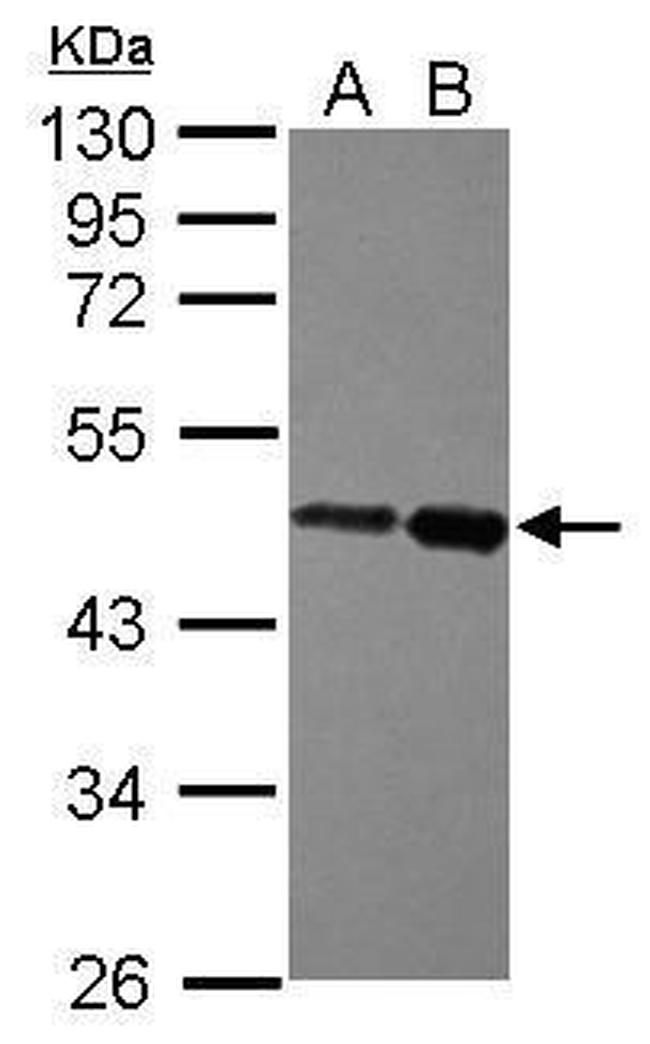 ZBTB26 Antibody in Western Blot (WB)