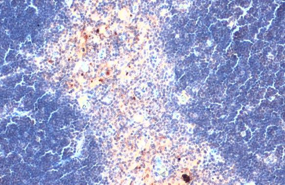 CXCL16 Antibody in Immunohistochemistry (Paraffin) (IHC (P))