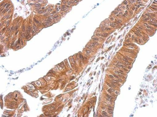 CXCL16 Antibody in Immunohistochemistry (Paraffin) (IHC (P))