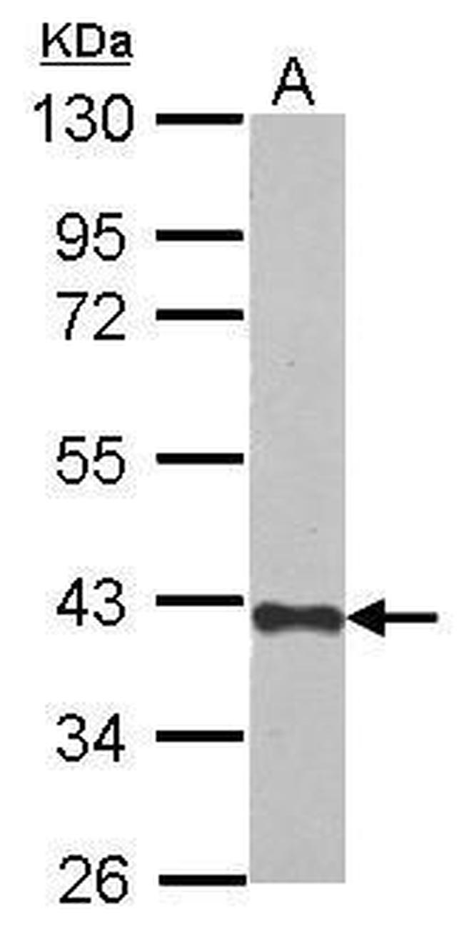 CREBZF Antibody in Western Blot (WB)