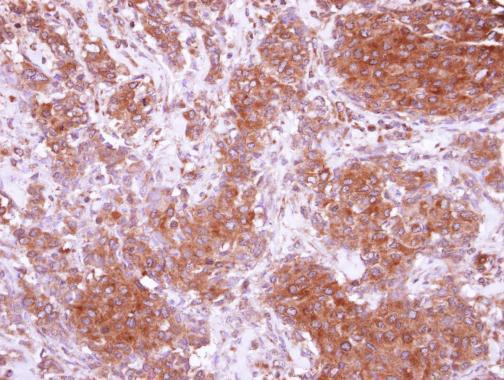 CIDEC Antibody in Immunohistochemistry (Paraffin) (IHC (P))