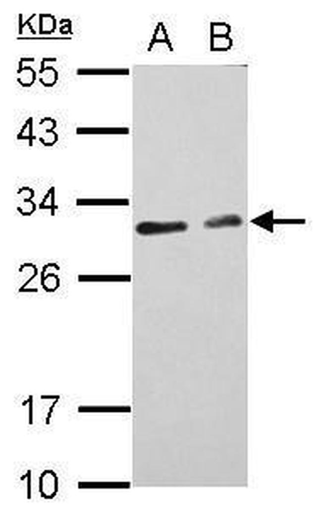 CIDEC Antibody in Western Blot (WB)