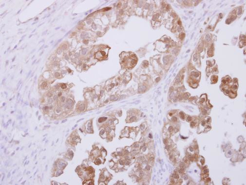 RBKS Antibody in Immunohistochemistry (Paraffin) (IHC (P))