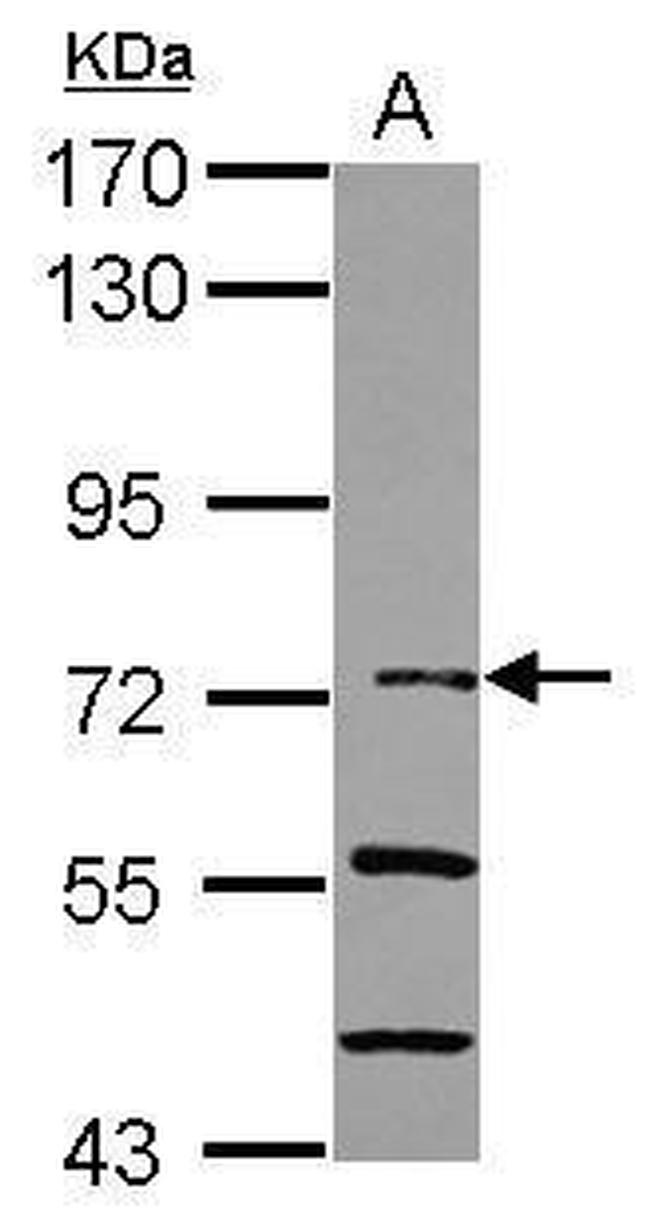 IkB zeta Antibody in Western Blot (WB)