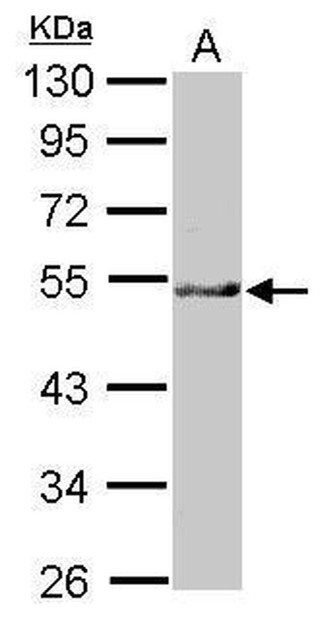 NARFL Antibody in Western Blot (WB)