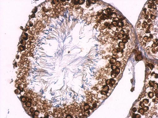 BOLL Antibody in Immunohistochemistry (Paraffin) (IHC (P))