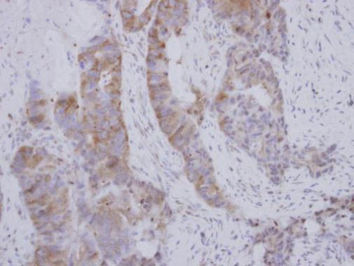 BOLL Antibody in Immunohistochemistry (Paraffin) (IHC (P))