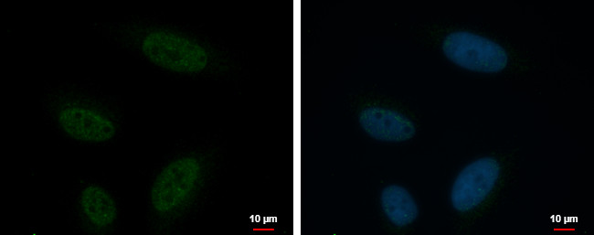 KCTD15 Antibody in Immunocytochemistry (ICC/IF)