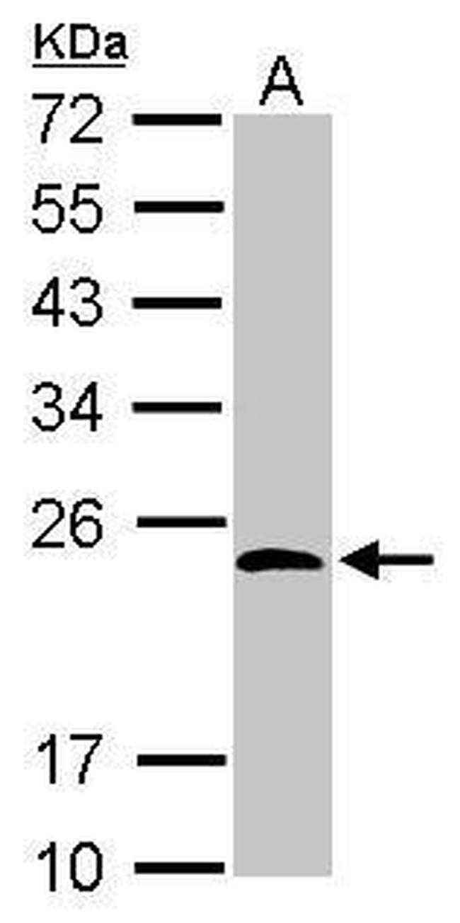 KCTD15 Antibody in Western Blot (WB)