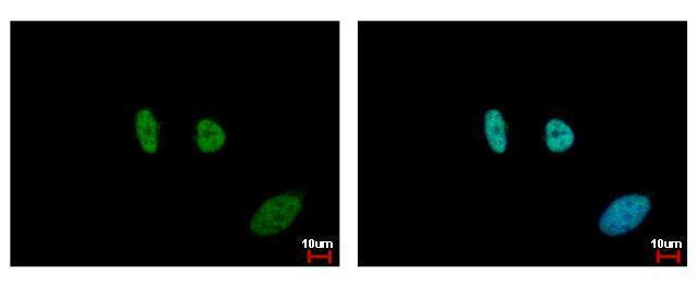 SMC6 Antibody in Immunocytochemistry (ICC/IF)