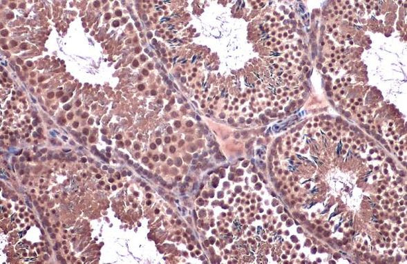 SMC6 Antibody in Immunohistochemistry (Paraffin) (IHC (P))