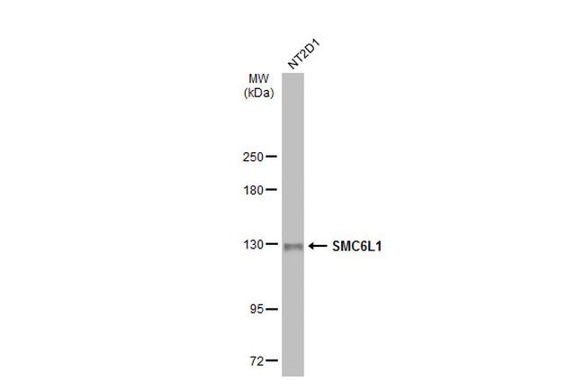 SMC6 Antibody in Western Blot (WB)