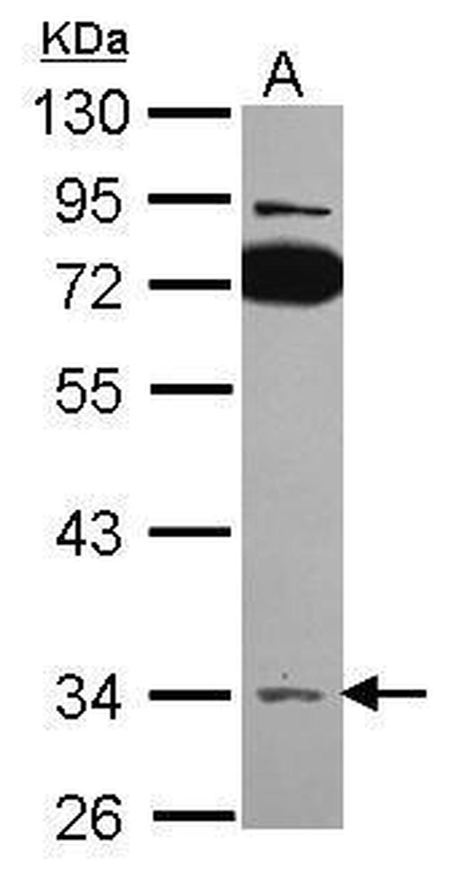 SLC25A22 Antibody in Western Blot (WB)