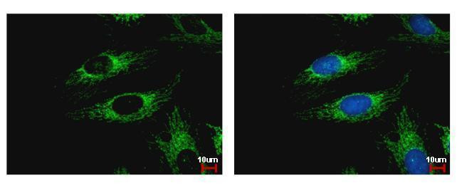 WDR61 Antibody in Immunocytochemistry (ICC/IF)