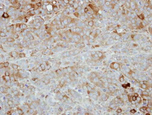 Nectin 4 Antibody in Immunohistochemistry (Paraffin) (IHC (P))