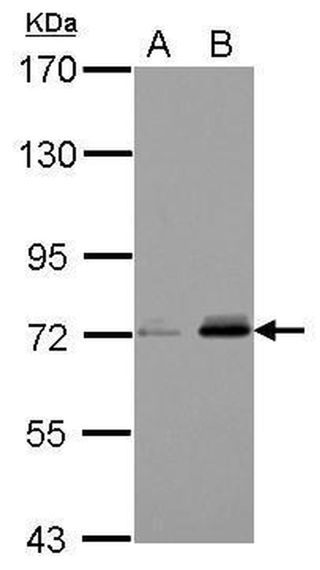 Kindlin 3 Antibody in Western Blot (WB)