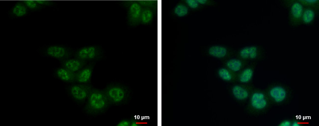 SETDB2 Antibody in Immunocytochemistry (ICC/IF)