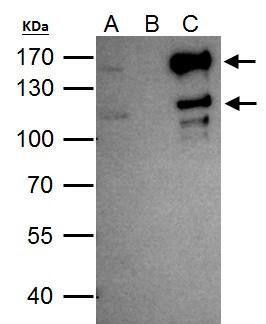 SETDB2 Antibody in Immunoprecipitation (IP)