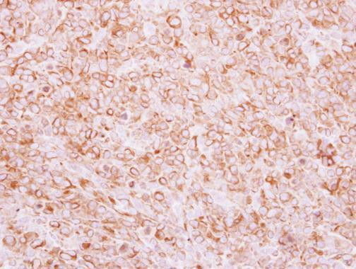 TEM8 Antibody in Immunohistochemistry (Paraffin) (IHC (P))