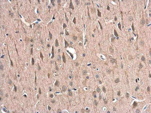 HIP1R Antibody in Immunohistochemistry (Paraffin) (IHC (P))