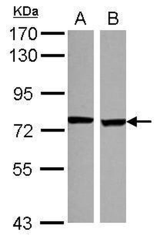 SCNN1D Antibody in Western Blot (WB)