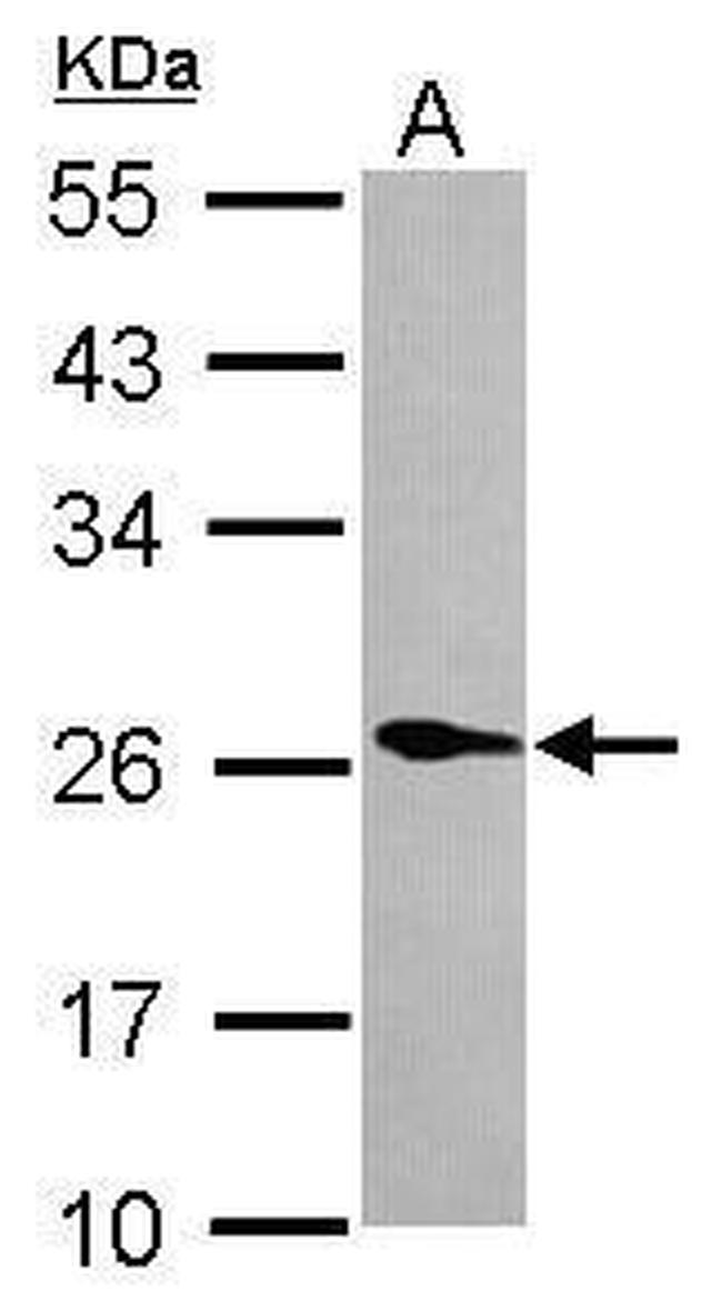 PLA2G12A Antibody in Western Blot (WB)