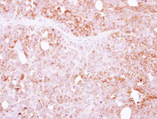 LIN7A Antibody in Immunohistochemistry (Paraffin) (IHC (P))