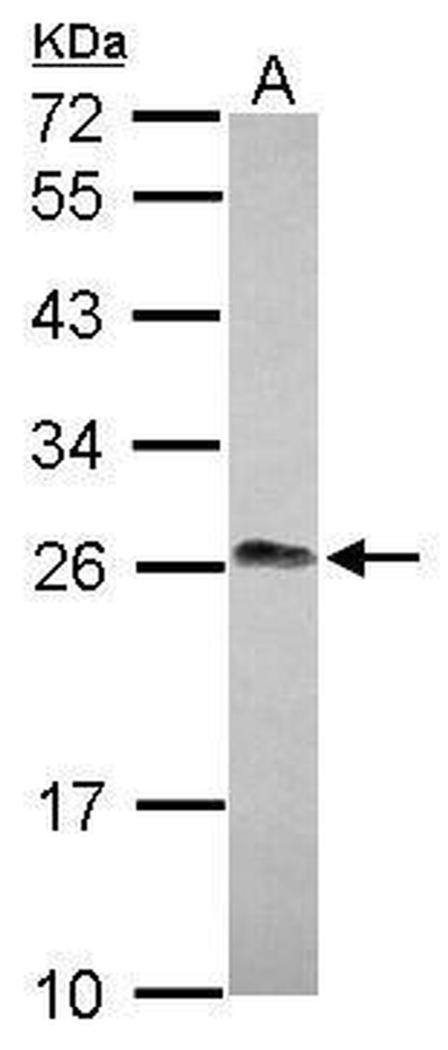 LIN7A Antibody in Western Blot (WB)