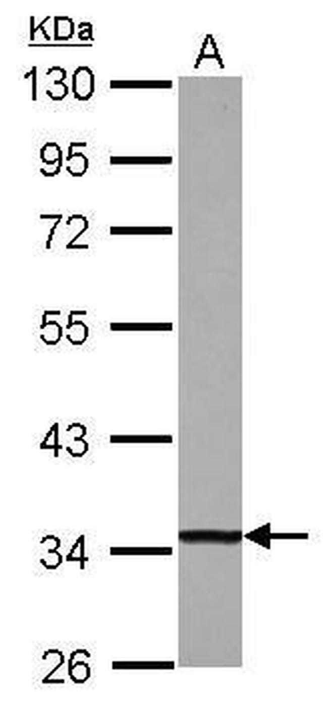 DECR1 Antibody in Western Blot (WB)