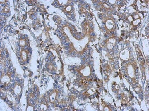 SEMA5A Antibody in Immunohistochemistry (Paraffin) (IHC (P))