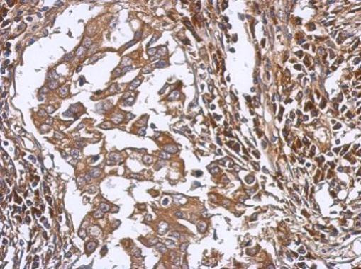 LAX1 Antibody in Immunohistochemistry (Paraffin) (IHC (P))