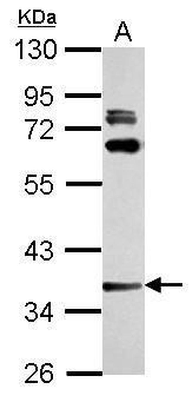 LAX1 Antibody in Western Blot (WB)