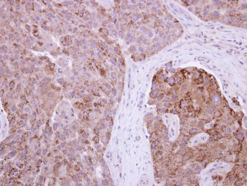 RAB11FIP1 Antibody in Immunohistochemistry (Paraffin) (IHC (P))