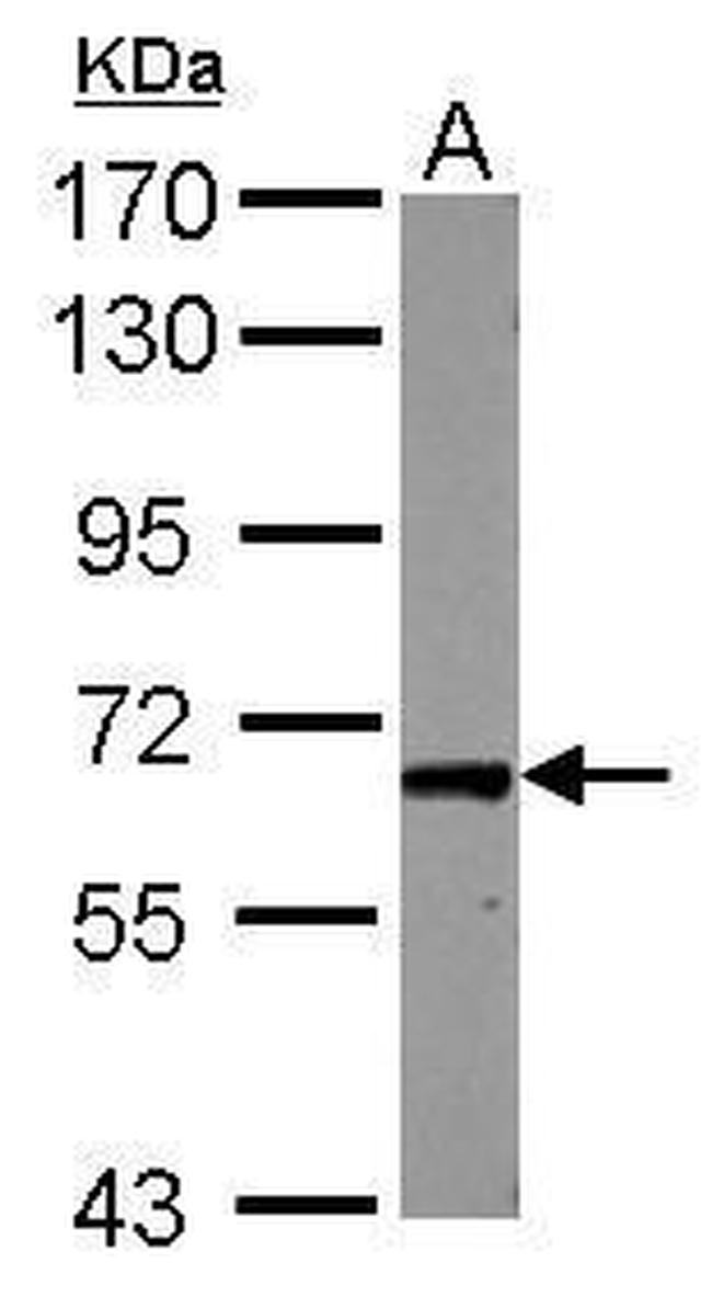 RAB11FIP1 Antibody in Western Blot (WB)