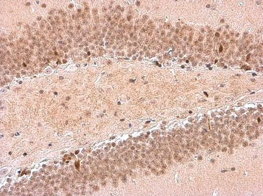 NFIX Antibody in Immunohistochemistry (Paraffin) (IHC (P))