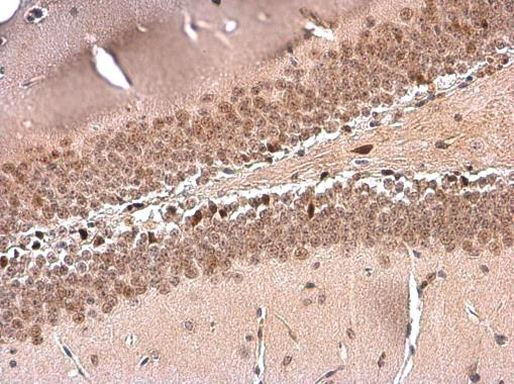 NFIX Antibody in Immunohistochemistry (Paraffin) (IHC (P))