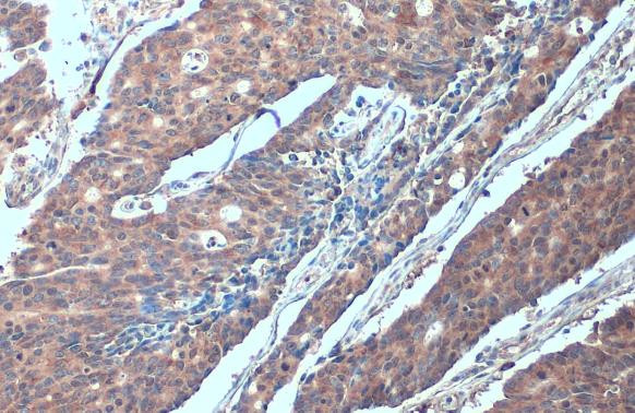 SMURF2 Antibody in Immunohistochemistry (Paraffin) (IHC (P))